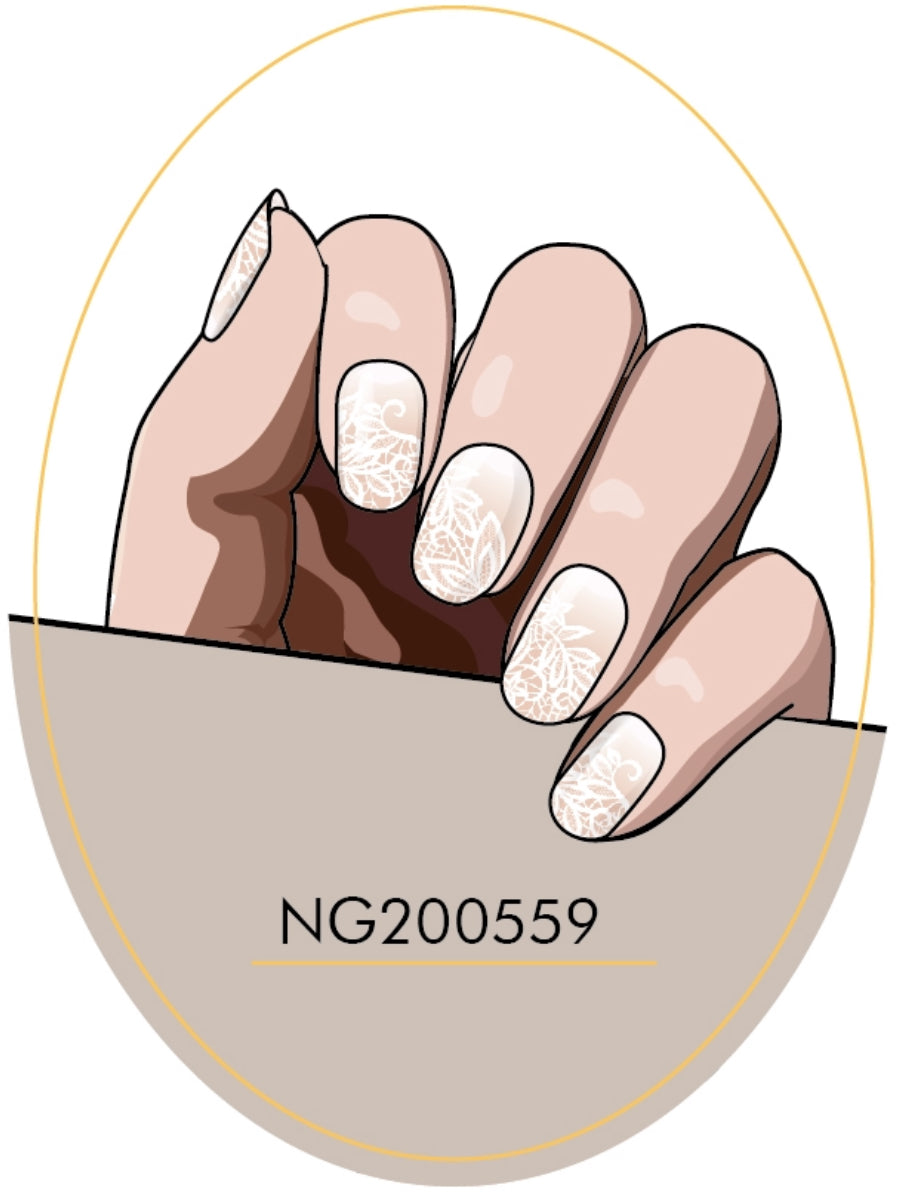 NG559